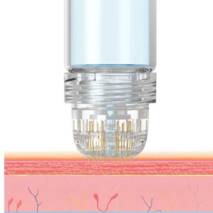 GOLD NEEDLING ONLINE TRAINING