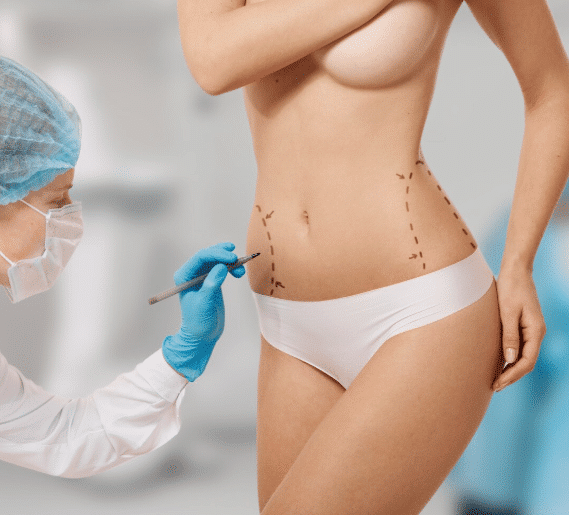 Natural Buttock Reshaping & Augmentation in Miami, FL